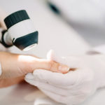 Dermatoložka mi našla nebezpečné znaménko. Co s tím a jak na prevenci?