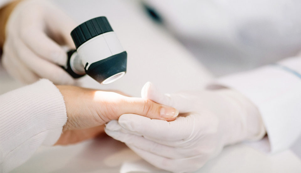 Dermatoložka mi našla nebezpečné znaménko. Co s tím a jak na prevenci?